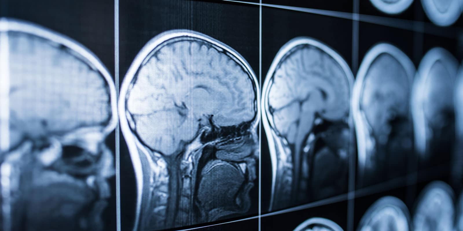Brain x-ray imaging.